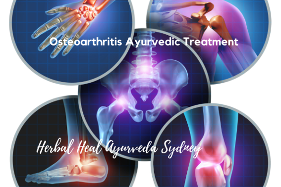 Herbal Heal Ayurveda Sydney-psoriasis treatment sydney australia